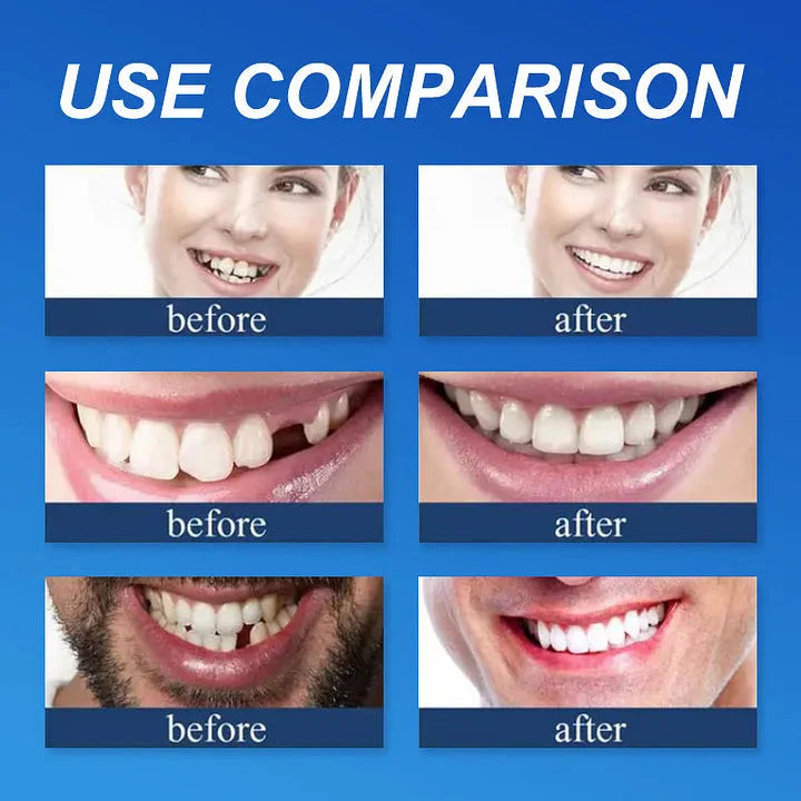 SecureSmile – Tandproteser med stærk binding